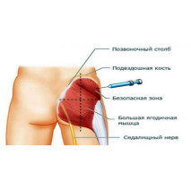 Как правильно колоть стероиды